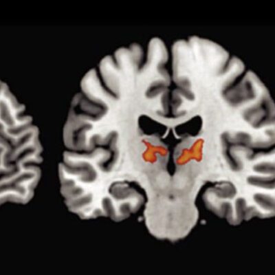 Brain Images