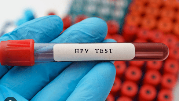 Image of an HPV test in a test tube.